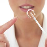 STÉRILET – Contraception féminine